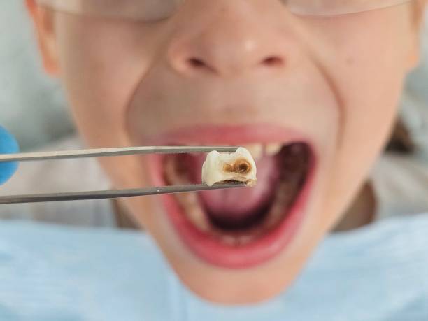 Best Mobile Emergency Dentist in USA